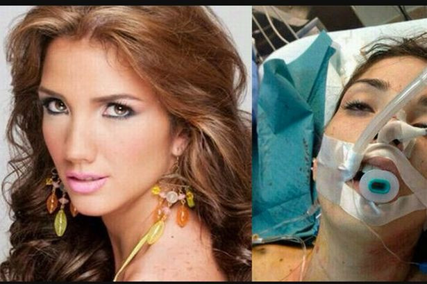 Показен разстрел! Пръснаха мозъка на втора Кралица на красотата във Венецуела!