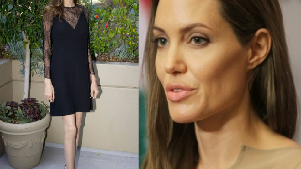 Близките на Анджелина Джоли са със свити сърца, болестта ѝ ги срази