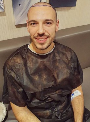 Реши се: Даниел Петканов си присади коса в Турция! (още подробности)