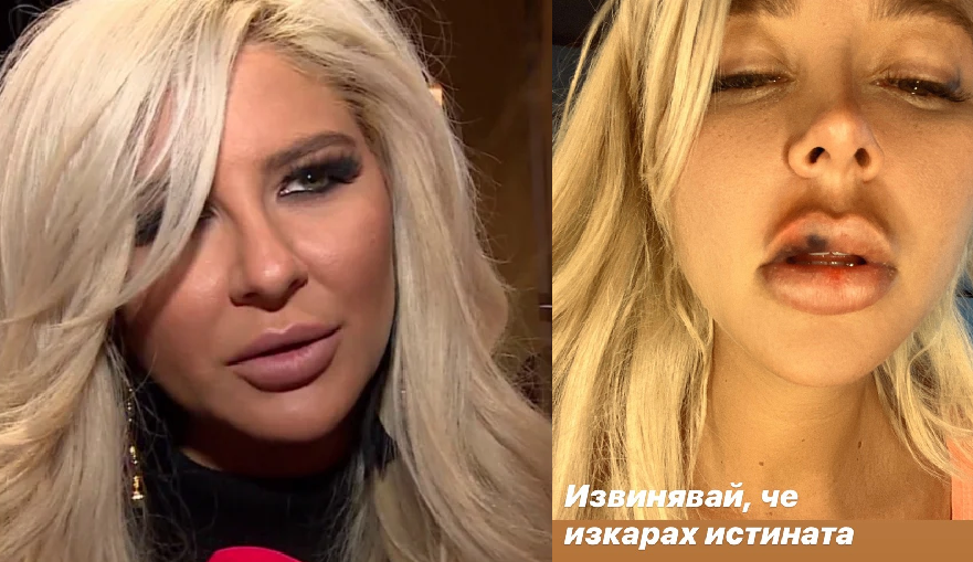 Отмъщението на Андреа: Певицата съди Кубрат Пулев за домашно насилие!