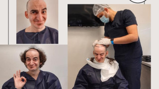 Направи го: Актьорът Ники Станоев се реши да си присади коса! (още подробности)