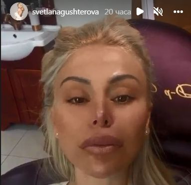 Светлана Гущерова се обезобрази! Манията й по пластичните операции съсипа лицето й (СНИМКИ)
