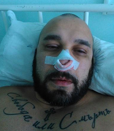 Мишо Шамара е претърпял операция заради своето хъркане
