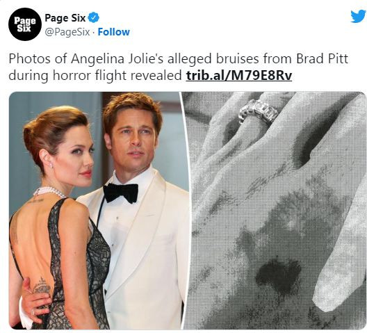 Анджелина Джоли доказа, че Брад й е посегнал в частния самолет (Вижте синините по ръцете й – Снимка)
