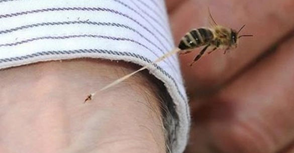 Алергия при ужилване от пчела се проявява до 30 минути