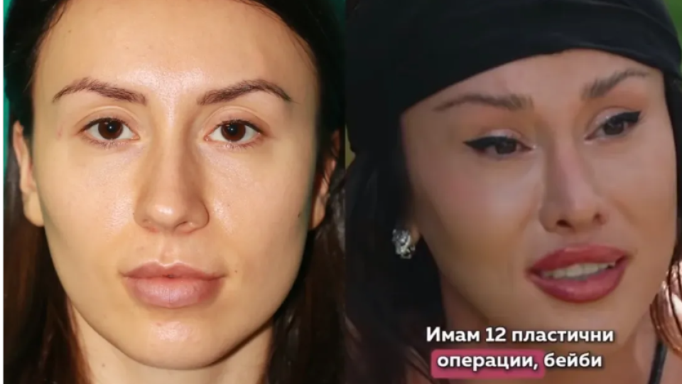 Санта Китана от „Ергенът“ е била красиво момиче преди бруталните корекции