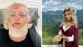 Жанета Осипова след зверския побой и тежката катастрофа: Господ има планове за мен, затова оцелях!