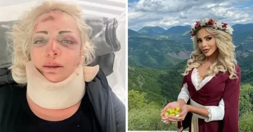 Жанета Осипова след зверския побой и тежката катастрофа: Господ има планове за мен, затова оцелях!
